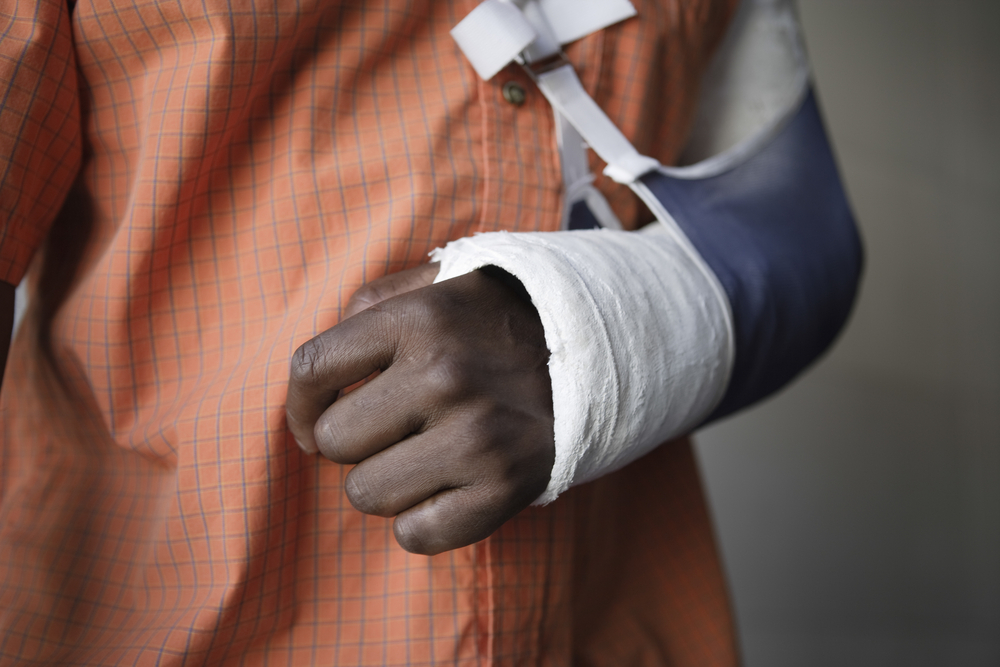 Injured worker with arm in cast, workers compensation lawyer